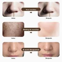 Máscara Facial LED Sin Cable De 7 Colores Máscara De Momia Egiptia Cléopatra 630nm Luz Roja Inteligente Para El Rostro Equipo De Cuidado De La Piel - details 11