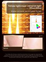 Máscara De Terapia LED Roja Nueva Llegada Con Luz Infrarroja Flexible Y Suave De Silicona 4 Colores Anti-Edad Photon Avanzado Para Rejuvenecimiento Y Blanqueamiento De Piel - details 7