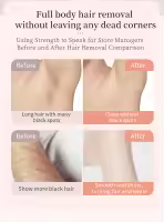 Afeitadora Eléctrica Para Mujer Epilador De Bikini Trimmer Shaver Eléctrico Para Área Privada Axilas Piernas Y Cabello Facial Eliminación De Pelo - details 4