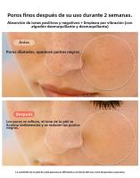 Dispositivo De Belleza RF Para Levantamiento Y Fortalecimiento Facial Rejuvenecimiento EMS Microcorriente Para El Hogar Regalo - details 5