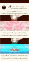 Dispositivo De Belleza RF Para Levantamiento Y Fortalecimiento Facial Rejuvenecimiento EMS Microcorriente Para El Hogar Regalo - details 8