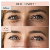Beauty of Joseon Suero de Ojos Antiedad con Ginseng y Retinal 30 ML - details 2