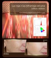 Máscara De Terapia LED Roja Nueva Llegada Con Luz Infrarroja Flexible Y Suave De Silicona 4 Colores Anti-Edad Photon Avanzado Para Rejuvenecimiento Y Blanqueamiento De Piel - details 5