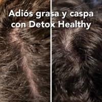Ybera Paris Pack Purificante Detox Healthy - Pack Profesional Tratamiento Anticaspa y Anti grasa - details 0