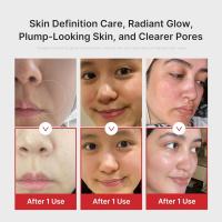 Medicube AGE-R Booster Pro Rosa Dispositivo de Belleza 6 en 1 para Glass Skin - details 4