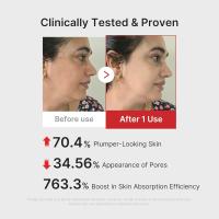 Medicube AGE-R Booster Pro Rosa Dispositivo de Belleza 6 en 1 para Glass Skin - details 5