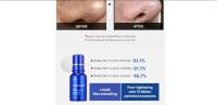 Medicube One Day Exosome Shot Pore Ampoule 7500 30ml – Sérum Facial Minimiza Poros y Reafirma,Limpieza de poros en profundidad,Exfolia puntos negros ,Sérum Facial K-Beauty 30ml Anti Poros y Textura NOVEDAD - details 2