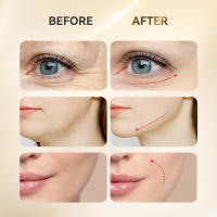 ANLAN Masajeador de puntos de acupuntura facial, levantamiento de nariz y ojos EMS, luz de 7 colores, Guasha, reduce la hinchazón, antienvejecimiento, reafirma la piel, herramienta Caerskin - details 6