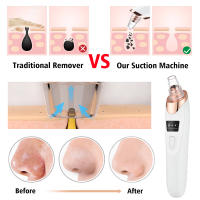Eliminador Eléctrico de Espinillas, Máquina al Vacío para Acné, Quitar Puntos Negros, Limpiador de Poros, Limpieza Facial Profunda, Herramientas Cuidado de la Piel - details 2