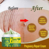 Elimina las cicatrices del embarazo, crema para el acné, tratamiento de estrías, reparación de maternidad, 7 días posparto, obesidad, cuidado de la piel seguro para la salud corporal - details 0