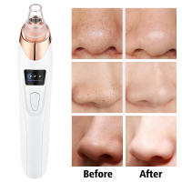Eliminador Eléctrico de Espinillas, Máquina al Vacío para Acné, Quitar Puntos Negros, Limpiador de Poros, Limpieza Facial Profunda, Herramientas Cuidado de la Piel - details 7