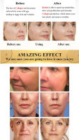 Crema Facial Retinol reafirmante Lifting antienvejecimiento líneas finas blanqueamiento brillo hidratante cuidado de la piel Facial 20g - details 6