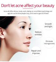 Crema Facial Retinol reafirmante Lifting antienvejecimiento líneas finas blanqueamiento brillo hidratante cuidado de la piel Facial 20g - details 5