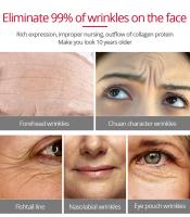 Crema Facial Retinol reafirmante Lifting antienvejecimiento líneas finas blanqueamiento brillo hidratante cuidado de la piel Facial 20g - details 2