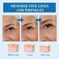 Crema para los Ojos Hidratante y Anti-arrugas Masajeador de Rolos para Cuidado de la Piel - details 7