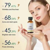 Cuidado facial Exfoliante Piel radiante Desvanece las manchas oscuras y la pigmentación para una piel aún más brillante Elimina las manchas Brazo Rodilla Piernas Melanina - details 0