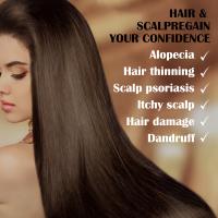 Esencia para tratamiento del cuero cabelludo, tratamiento anticaspa para psoriasis, alivia la descamación, la picazón, potenciador de folículos, suero nutritivo para el cabello - details 9