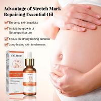Removedor de estrías, aceite de reparación de cicatrices de maternidad, aceite de tratamiento para el cuidado de la piel, reparación de estrías, mejora la elasticidad, firmeza de la piel - details 1
