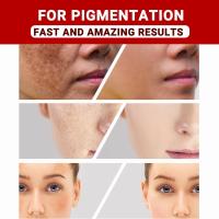 Crema Blanqueadora Efectiva para Manchas Negras Serum de Eliminación de Melasma - details 8