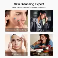Aguja Visual inteligente para el acné, dispositivo de eliminación de acné Facial, limpieza de poros, instrumento de belleza, carga USB - details 4