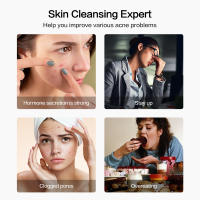 Aguja Visual inteligente para el acné, dispositivo de eliminación de acné Facial, limpieza de poros, instrumento de belleza, carga USB - details 4