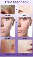 Textura de la piel |   Suero facial iluminador y retexturizante para refinar los poros con retinol y niacinamida no comedogénico - details 2