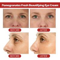 Crema antiarrugas para ojos, antiojeras y bolsas en el contorno de los ojos, hinchazón, crema hidratante facial, productos coreanos para el cuidado de la piel, 20g - details 5