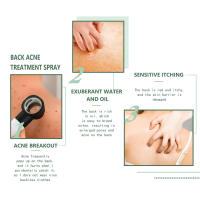Spray para tratamiento del acné en la espalda, eliminación de manchas, suero, Control de aceite, reduce los poros, hidratante, ácido salicílico, cuidado de la piel - details 7