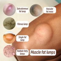 Crema calmante para el cuidado de la piel, eliminador de bultos subcutáneos, alivia la aglomeración corporal, bloques duros, crema para el cuidado de la piel del cuerpo - details 6