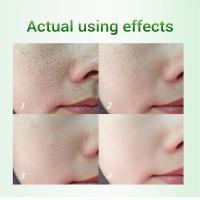 Crema para reducir los poros con ácido salicílico, crema para refinar los poros grandes, mejorar el acné facial, crema para eliminar puntos negros, Control de aceite antienvejecimiento, cuidado de la piel - details 4