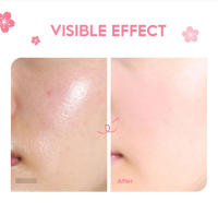 Crema Esencial Hidratante de Sakura LAIKOU Mini Tamaño de Viaje Cuidado de la Piel Nutritivo Blanqueador Herramientas de Cuidado de la Piel Facial - details 9