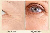 Crema Mágica para Ojos anti-Arrugas Reducción de Líneas Finas en 7 Días - details 6