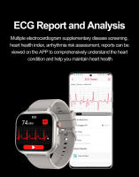 2025 Nuevo VE31 Smartwatch SOS Llamada de emergencia ECG Temperatura Detección de frecuencia cardíaca Asistente de voz Modo deportivo Compatible con Android IOS Bluetooth Smartwatch - details 10