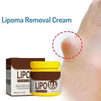 Crema calmante para el cuidado de la piel, eliminador de bultos subcutáneos, alivia la aglomeración corporal, bloques duros, crema para el cuidado de la piel del cuerpo - details 2