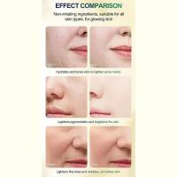 Cuidado facial Exfoliante Piel radiante Desvanece las manchas oscuras y la pigmentación para una piel aún más brillante Elimina las manchas Brazo Rodilla Piernas Melanina - details 7