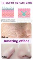 Textura de la piel |   Suero facial iluminador y retexturizante para refinar los poros con retinol y niacinamida no comedogénico - details 9