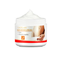 Crema de Reparación de Escaras Tratamiento Eficaz para Marcas de Embarazo - details 1