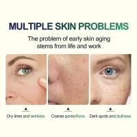 Cuidado facial Exfoliante Piel radiante Desvanece las manchas oscuras y la pigmentación para una piel aún más brillante Elimina las manchas Brazo Rodilla Piernas Melanina - details 5