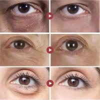 Crema para los Ojos Hidratante Adiós a las Ojeras, Reducción de Hinchazón, Reafirmación y Reparación de la Piel Herramientas de Cuidado de la Piel Facial - details 1