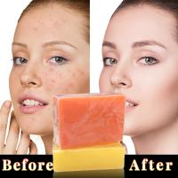 Jabón blanqueador de ácido kójico, Kit de 2 uds hecho a mano, Reduce el punto de drak, melasma, limpieza profunda, brillo de la piel, suave e hidrataizado - details 11