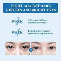 Crema para los Ojos Hidratante y Anti-arrugas Masajeador de Rolos para Cuidado de la Piel - details 9