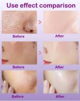 Textura de la piel |   Suero facial iluminador y retexturizante para refinar los poros con retinol y niacinamida no comedogénico - details 3