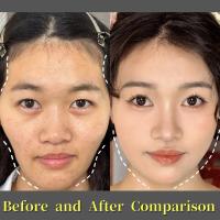 Mascarilla de Nutrición Profunda para Reafirmar la Piel Facial Parche Hidrocristalino Anti-Envejecimiento Lifting para Estomación - details 3