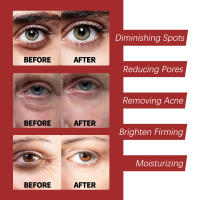 Retinol Moisturizer Face Cream Repairing Moisturizing Nourishing Cream Brightening Skin Facial Cream Anti-Aging Face Skin Care - details 5