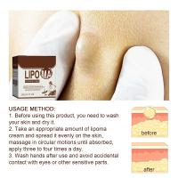 Crema calmante para el cuidado de la piel, eliminador de bultos subcutáneos, alivia la aglomeración corporal, bloques duros, crema para el cuidado de la piel del cuerpo - details 9