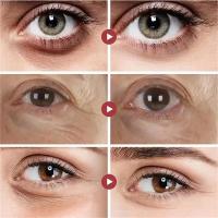 Crema para los Ojos Elimina Ojeras, Ajusta, Levanta y Reafirma Haz More Vibrante tu Mirada - details 4
