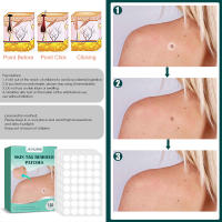 Parche eliminador de etiquetas para la piel, tratamiento de verrugas, acné, granos, pegatinas absorbentes, Gel hidrocoloide, antiinfección, cuidado de la piel, 120 piezas - details 10
