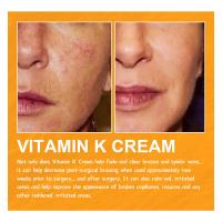 Crema para tratamiento de venas varicosas, alivia el dolor de arañas en las piernas, Vasculitis, eliminador de flebitis, ungüento reparador de vitamina K, tratamiento de relajación - details 4