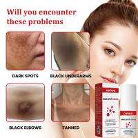 Crema Blanqueadora Efectiva para Manchas Negras Serum de Eliminación de Melasma - details 1