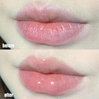 Kit de Labios de Gelatina de Melocotón Hidratación, Suavizante, Anti-secado - details 3